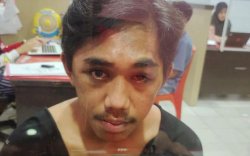 Dipaksa Bantu Pacar Onani, Gadis Lutra Ini Berusaha Bunuh Diri dengan Minum Obat Anti Nyamuk