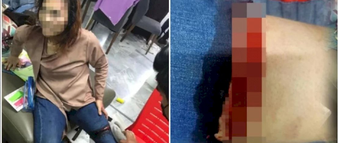 Korban penganiayaan polisi Malaysia. Korban penganiayaan polisi Malaysia.
