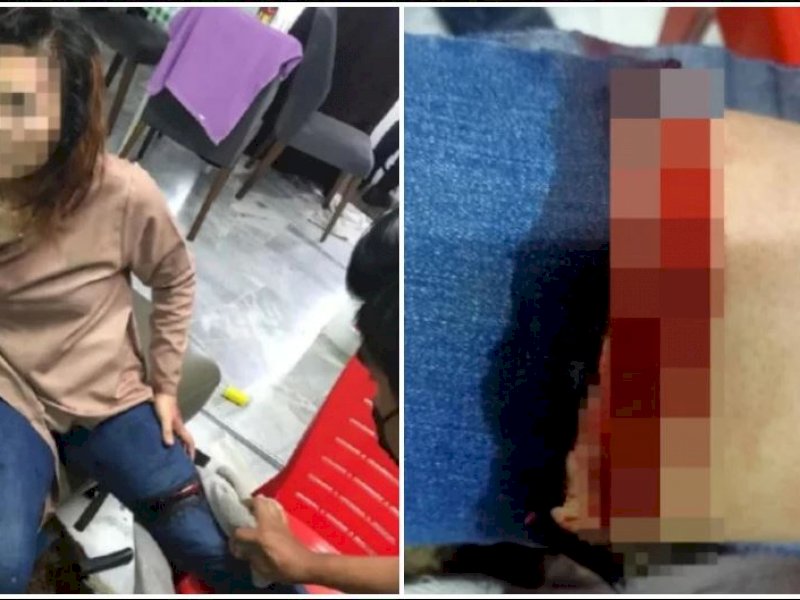 Cemburu Pacarnya Selingkuh, Polisi Malaysia Pukul Korban dengan Batang Besi