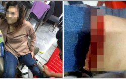 Cemburu Pacarnya Selingkuh, Polisi Malaysia Pukul Korban dengan Batang Besi