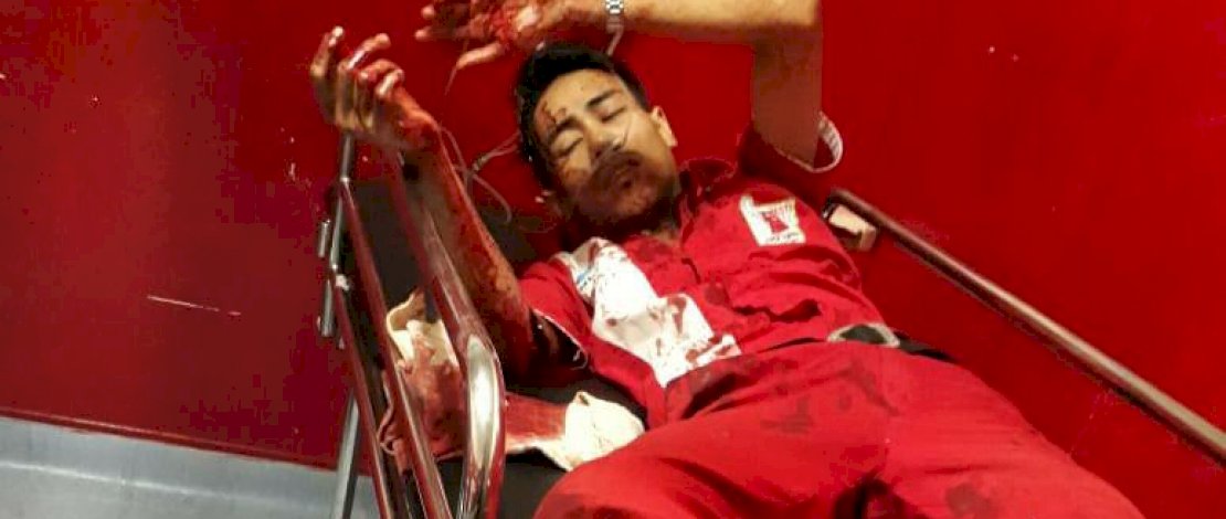 Ditegur Jangan Merokok, Karyawan SPBU ini Dikeroyok, Kepalanya Nyaris Ditebas