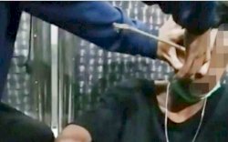 Lagi Asyik Naik Motor pada Dini Hari, Tiba-tiba Sebuah Anak Panah Menancap di Pelipis Pemuda Makassar Ini