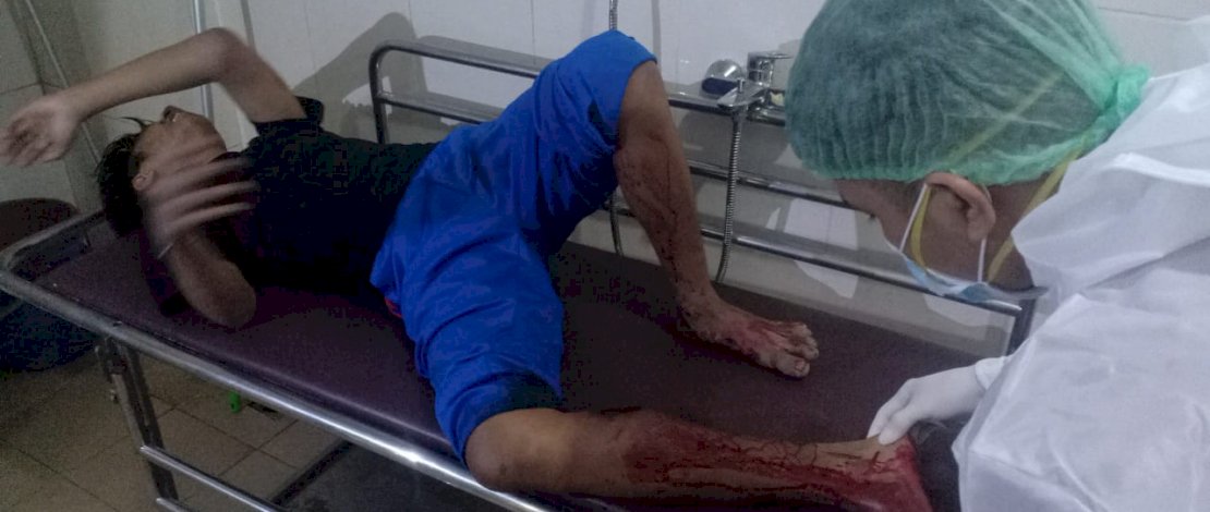 Karel Tapianus mendapatkan perawatan pada kaki, usai tertembus timah panas saat mencoba kabur.