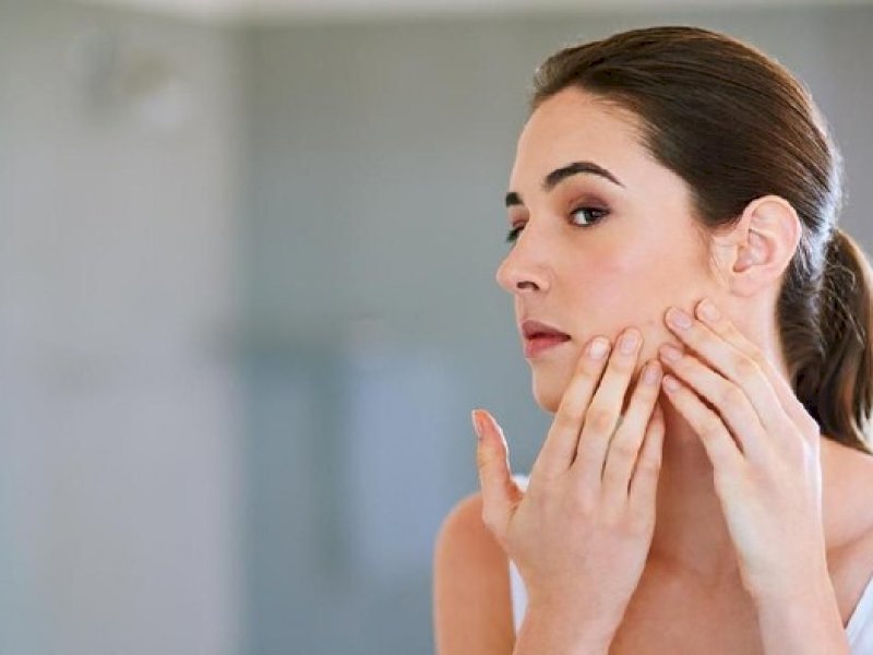 10 Cara Ampuh Hilangkan Flek Hitam Bekas Jerawat