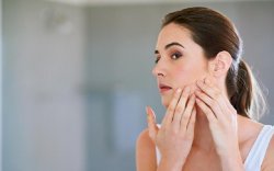 10 Cara Ampuh Hilangkan Flek Hitam Bekas Jerawat