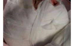 Kejam, Ibu Tiri Masukkan Balita ke Bak Air Panas