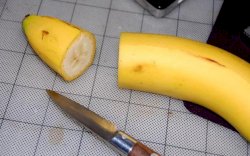 Pemuda Ini Nekat Potong Kelaminnya Sendiri dengan Pisau