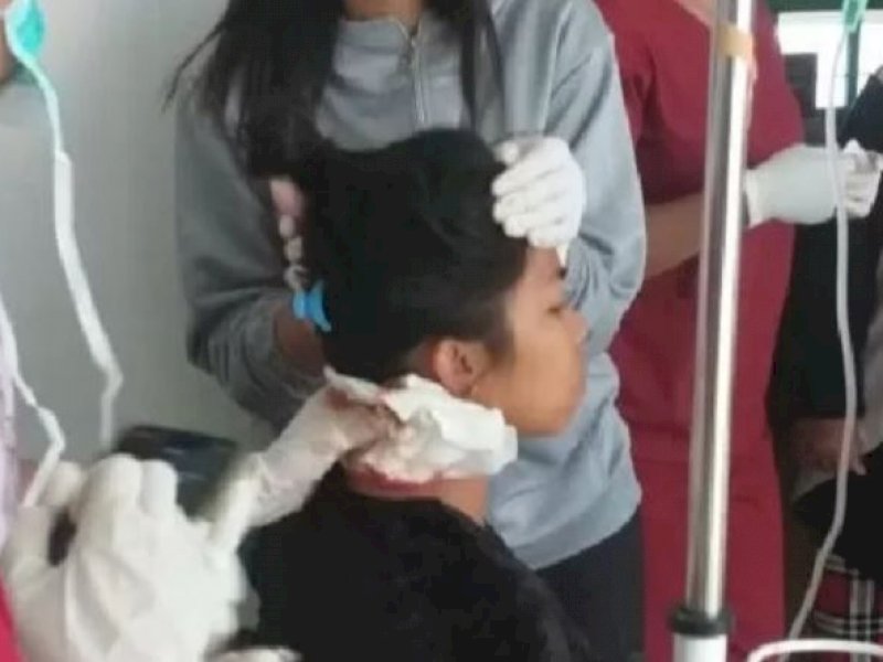Pengecut! KKB Papua Bacok IRT, Saat Adik Lelaki Korban Keluar, Mereka Terbirit-birit Kabur
