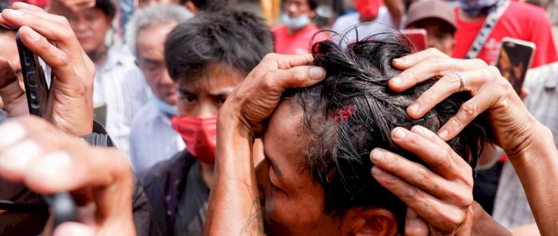 Seorang pria terluka oleh peluru karet saat protes di Mandalay pada 20 Februari 2021. (Foto: Reuters)
