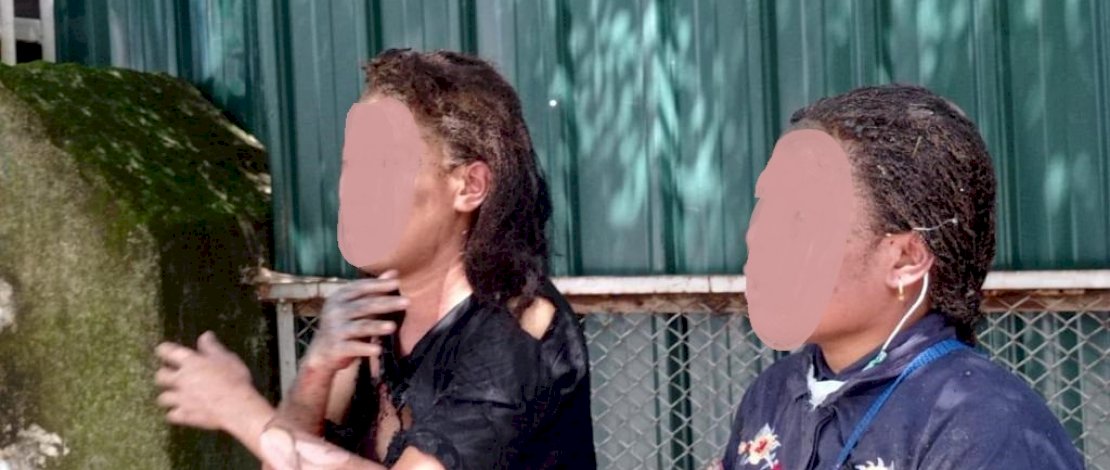 Korban ledakan bom bunuh diri di depan Gereja Katedral Makassar.