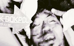 Potongan Kepala Terduga Pelaku Bom Bunuh Diri Gereja Katedral Ditemukan di Atap, Ini Penampakannya