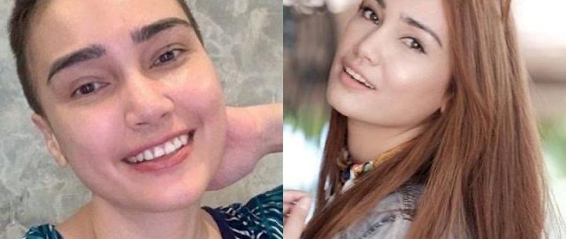 Foto Feby Febiola sewaktu dinyatakan terbebas dari kanker rahim.