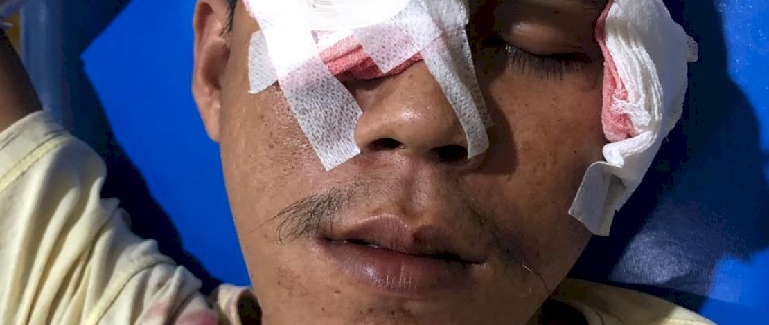 Korban tawuran di Jl Kandea III, Makassar. 