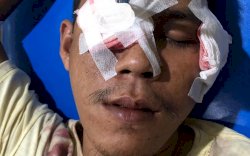 Ihh...Anak Panah Menancap di Mata Kanan Pria Ini Usai Tawuran di Jl Kandea