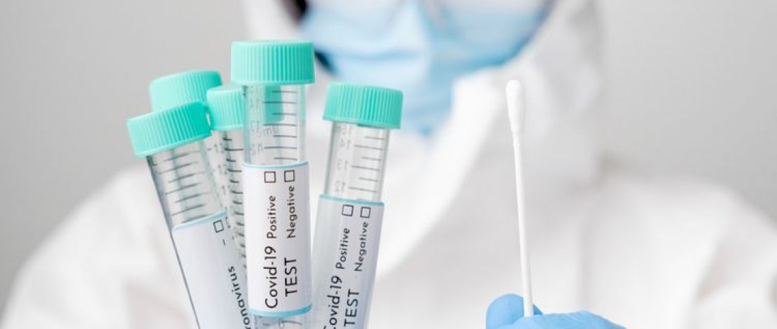 Pakar Ekonomi Minta Pemerintah Turunkan Harga PCR 