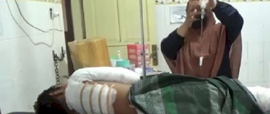 Kebakaran di Pinrang, dan para korban luka.