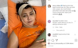 Gara-Gara Filler, Wajah Artis Ini Membatu dan Mengeluarkan Nanah
