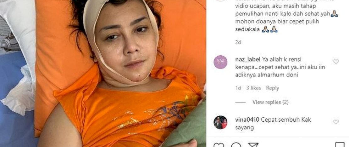 Gara-Gara Filler, Wajah Artis Ini Membatu dan Mengeluarkan Nanah