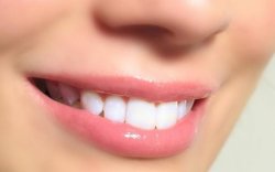 Lakukan 4 Hal Ini Agar Gigi dan Mulutmu Tetap Bersih dan Sehat 