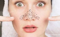 Berikut Cara Menghilangkan Komedo Tanpa Harus ke Klinik Kecantikan