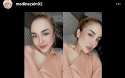 Medina Zein Beberkan Alasannya Melepas Hijab, Salah Satunya Karena Permasalahan Hidup  