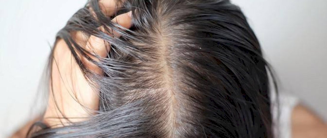 Tips Sederhana Merawat Rambut Lepek Agar Kembali Indah, Salah Satunya Hindari Produk Berbahan Silikon