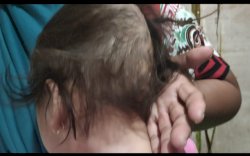 Kepala Desa Taring Turun Tangan Bantu Balita di Gowa yang Alami Pembesaran di Kepala