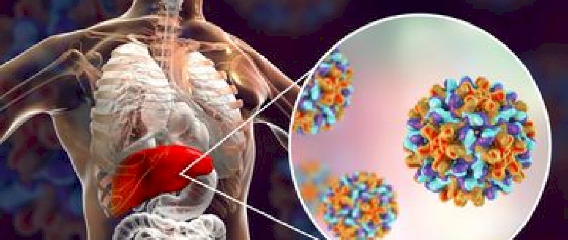Bisakah Hepatitis Akut Serang Orang Dewasa? Ini penjelasan Kemenkes Bisakah Hepatitis Akut Serang Orang Dewasa? Ini penjelasan Kemenkes