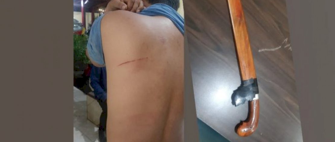 Tagih Pinjaman Koperasi, Pemuda di Makassar Malah Ditebas Golok