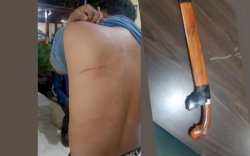 Tagih Pinjaman Koperasi, Pemuda di Makassar Malah Ditebas Golok