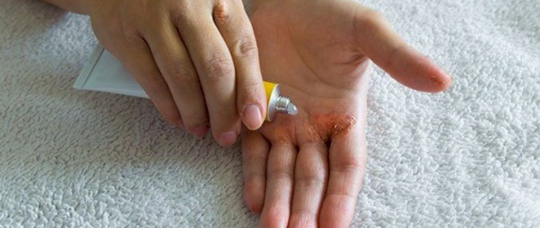 Gentamicin: Kegunaan, Aturan Pakai, dan Efek Samping