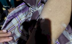 Listrik Perangkap Babi di Kebun Tewaskan Warga di Bulukumba