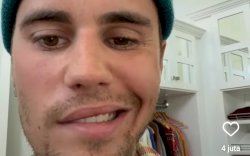 Terkena Virus Ramsay Hut, Wajah Justin Bieber Lumpuh Sebelah