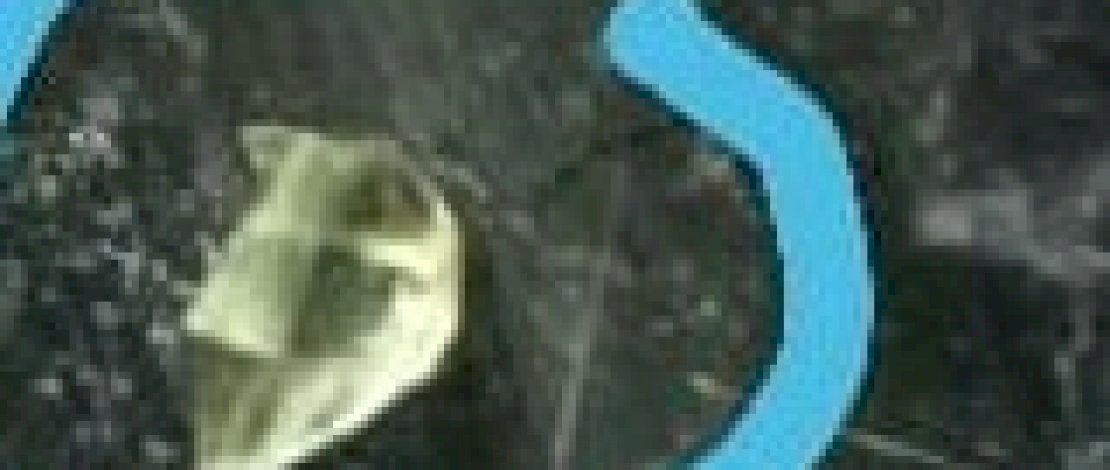 Serpihan kaca yang ditemukan di luka pasien L, sebulan setelah mendapatkan perawatan di Puskesmas Tamalatea, Jeneponto.