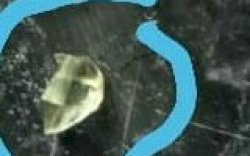 Diduga Korban Malpraktik, Ditemukan Serpihan Kaca di Luka, Usai Dirawat di Puskesmas Tamalatea