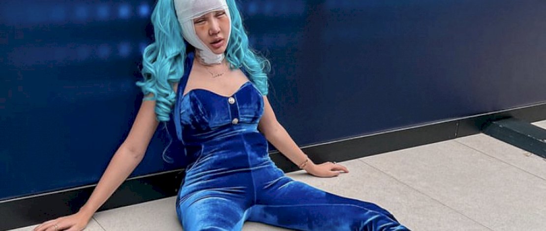 Potret lucinta luna usai melakukan operasi plastik di wajah dan lehernya.