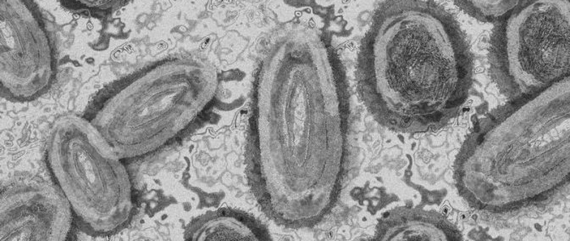 Ilustrasi Virus Cacar Monyet