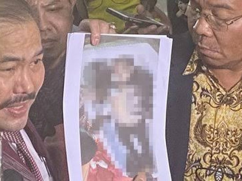 Diumumkan Dokter Forensik, Ini Hasil Autopsi Brigadir J