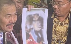 Diumumkan Dokter Forensik, Ini Hasil Autopsi Brigadir J
