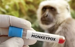 Dua Pasien Suspek di Makassar Negatif Cacar Monyet