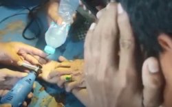 Dicopot Pakai Gurinda, Jari Pelajar di Parepare Membengkak Akibat Cincin Tidak Bisa Lepas 