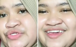 Muncul di Instagram Jokowi, Intan Lembata: Pengen Ketemu Presiden