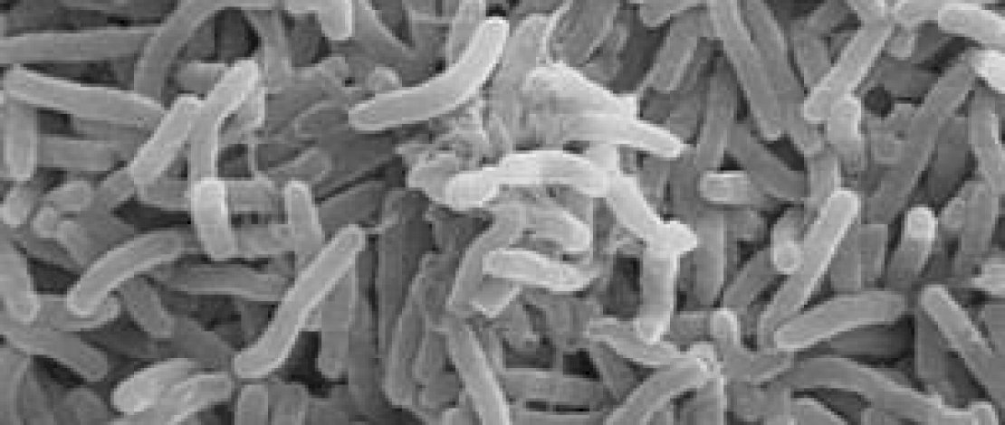 Virus Kolera dilihat dengan mirkroskop Virus Kolera dilihat dengan mirkroskop