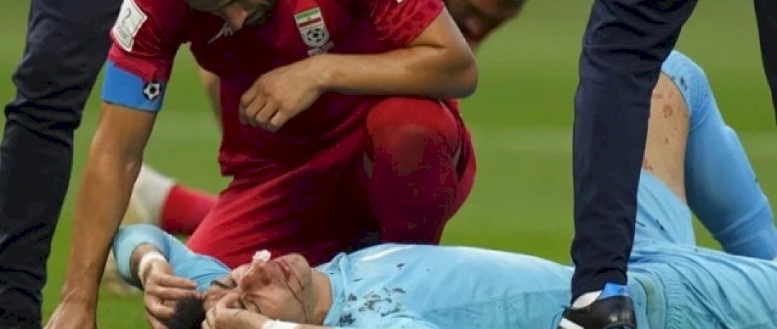Darah Alireza Beiranvand kiper Iran berceceran di jersey dan kaki. Photo : AP Photo/Alessandra Tarantino
