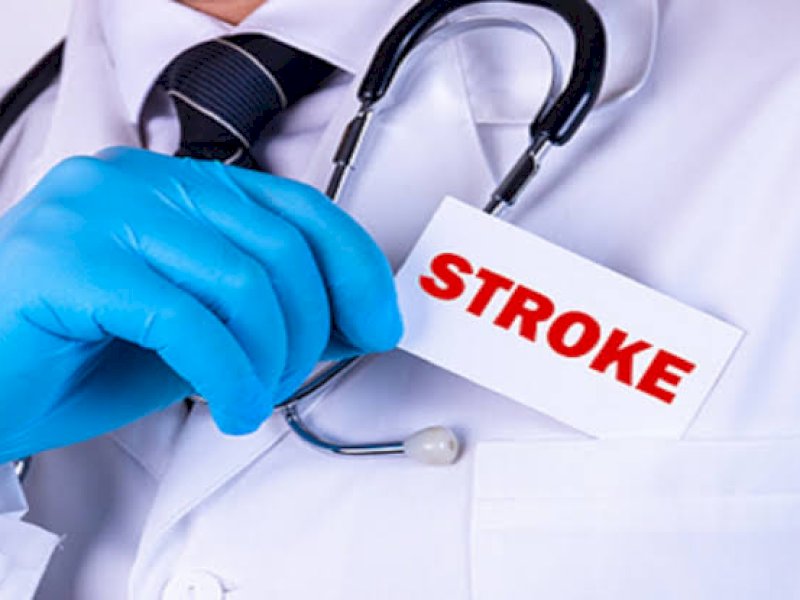 Waspada! Stroke Banyak Menyerang Anak Muda, Kenali Gejalanya