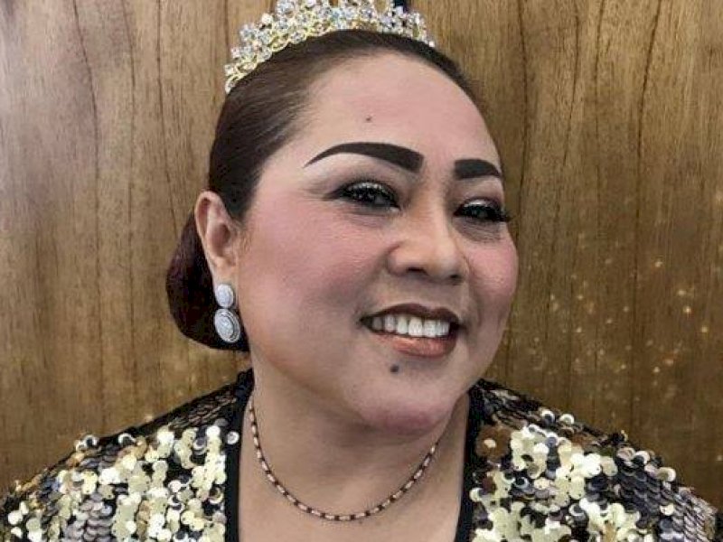 Nunung Ungkap Soal Kanker Payudara yang Menyerangnya: Tak Bisa Angkat Tas dan Berdiri Lama 