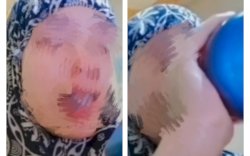 Tragis, Wanita Ini Minum Cairan Kimia Hingga Tewas, Diduga Karena Cinta 