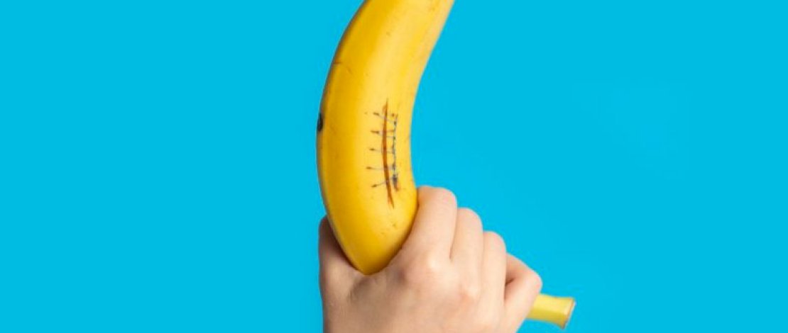 Hati-hati.!! Penis Bengkok saat Ereksi Sangat Berisiko Kena Kanker Hati-hati.!! Penis Bengkok saat Ereksi Sangat Berisiko Kena Kanker