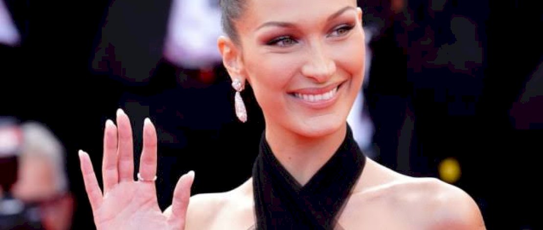 Mengenal Penyakit Lyme yang Diidap Bella Hadid Sampai Harus Dirawat di RS 