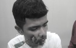 Duduk Santai di Depan Rumah, Anak Panah Tiba-tiba Menancap di Pipi Pemuda Ini